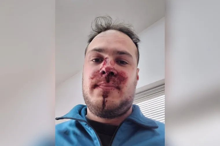 UNA PERSONA FUE AGREDIDA EN EL CERRO PELADO. FUE UN MOMENTO INESPERADO, NOS GOLPEARON Y APUNTARON CO